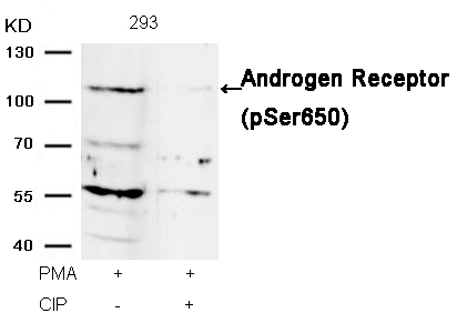 Androgen Receptor(Phospho-Ser650) Antibody