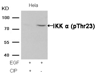 IKK a(Phospho-Thr23) Antibody
