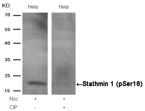 Stathmin1(Phospho-Ser16) Antibody