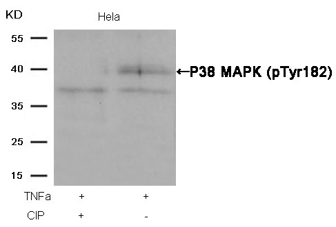 P38 MAPK(Phospho-Tyr182) Antibody
