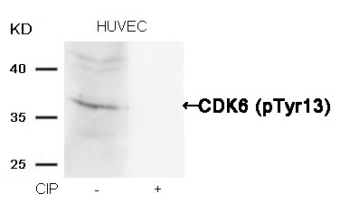 CDK6(phospho-Tyr13) Antibody