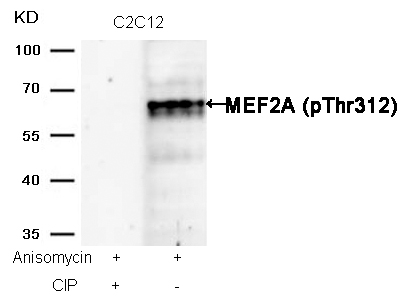 MEF2a(Phospho-Thr312) Antibody