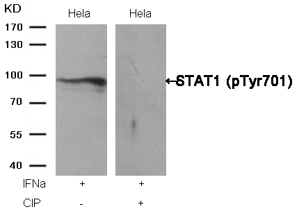 STAT1(Phospho-Tyr701) Antibody