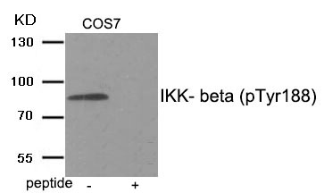 IKK- beta (Phospho-Tyr188) Antibody