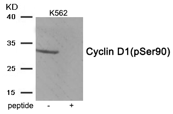 Cyclin D1 (Phospho-Ser90) Antibody