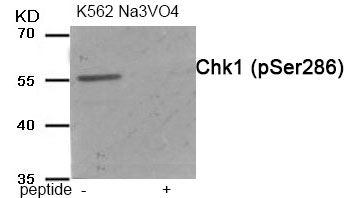 Chk1 (Phospho-Ser286) Antibody