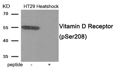 Vitamin D Receptor (Phospho-Ser208) Antibody