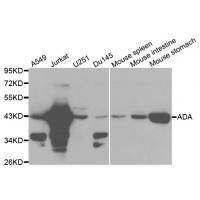 ADA Antibody