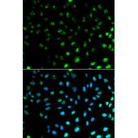 S100A8 Antibody