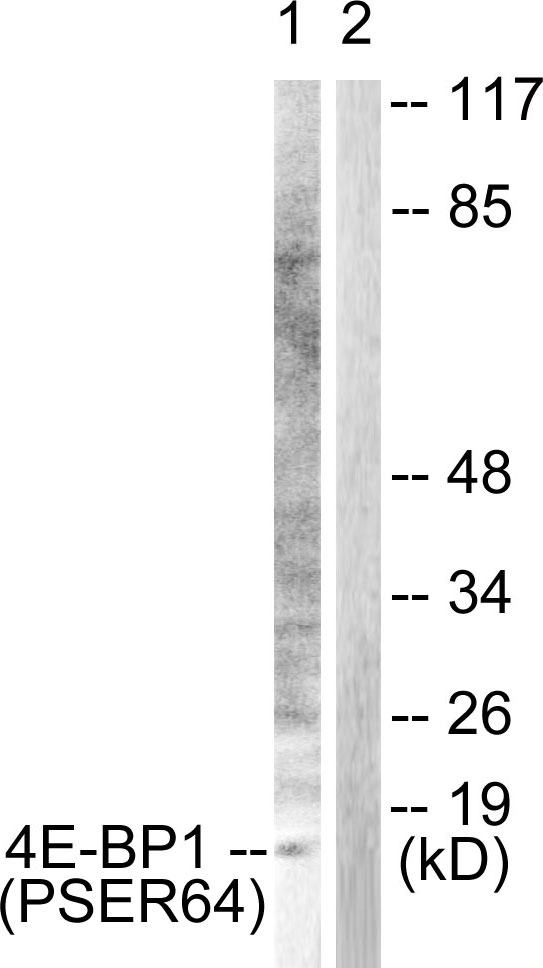 4E-BP1 (Phospho-Ser64) Antibody