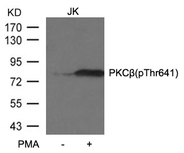 PKCb(Phospho-Thr641) Antibody