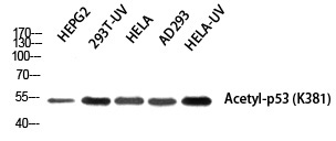 p53 (Acetyl-Lys381) Polyclonal Antibody