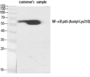 NFκB-p65 (Acetyl-Lys310) Polyclonal Antibody