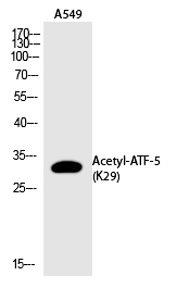 ATF-5 (Acetyl-Lys29) Polyclonal Antibody