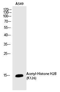 Histone H2B (Acetyl-Lys126) Polyclonal Antibody