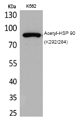 HSP 90 (Acetyl-Lys292/284) Polyclonal Antibody