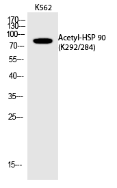 HSP 90 (Acetyl-Lys292/284) Polyclonal Antibody