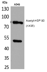 HSP 90 (Acetyl-Lys435) Polyclonal Antibody