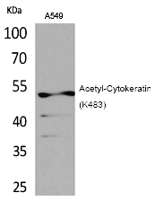 Cytokeratin 8 (Acetyl-Lys483) Polyclonal Antibody