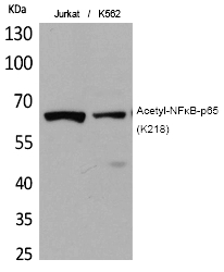 NFκB-p65 (Acetyl-Lys218) Polyclonal Antibody