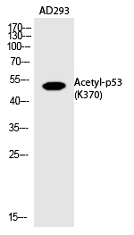 p53 (Acetyl-Lys370) Polyclonal Antibody