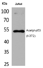 p53 (Acetyl-Lys372) Polyclonal Antibody