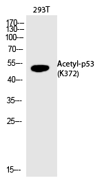p53 (Acetyl-Lys372) Polyclonal Antibody