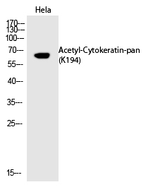Cytokeratin-pan (Acetyl-Lys194) Polyclonal Antibody