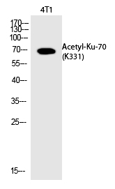 Ku-70 (Acetyl-Lys331) Polyclonal Antibody