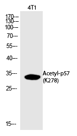 p57 (Acetyl-Lys278) Polyclonal Antibody