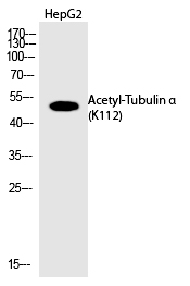 Tubulin α (Acetyl-Lys112) Polyclonal Antibody