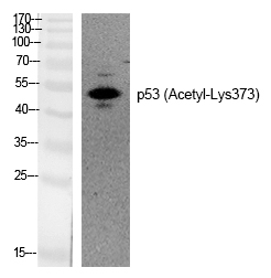 p53 (Acetyl-Lys373) Polyclonal Antibody