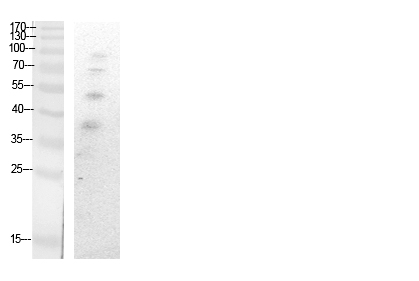 Ub (Acetyl-Lys27) Polyclonal Antibody