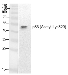 p53 (Acetyl-Lys320) Polyclonal Antibody