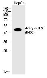 PTEN (Acetyl-Lys402) Polyclonal Antibody