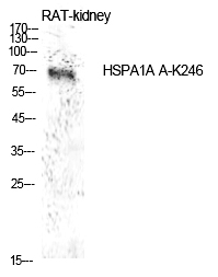 HSP70 (Acetyl-Lys246) Polyclonal Antibody