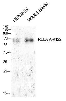 NFκB-p65 (Acetyl-Lys122) Polyclonal Antibody