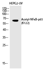 NFκB-p65 (Acetyl-Lys122) Polyclonal Antibody