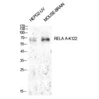 NFκB-p65 (Acetyl-Lys122) Polyclonal Antibody
