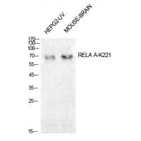 NFκB-p65 (Acetyl-Lys221) Polyclonal Antibody