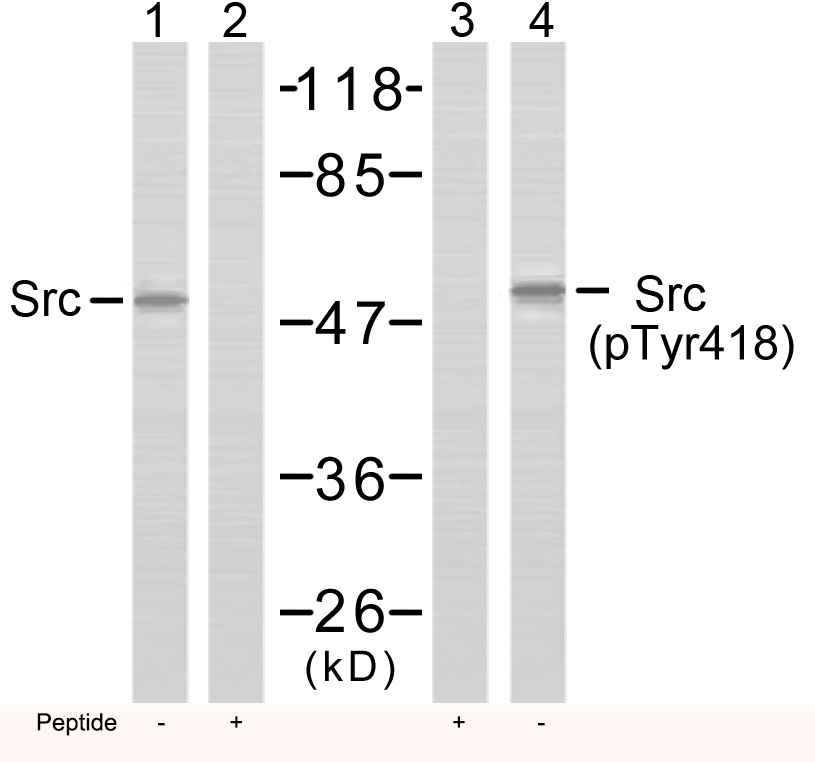 Src(Phospho-Tyr418) Antibody