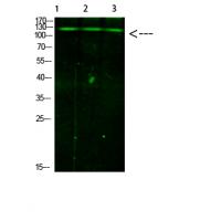 JAK2/3 (Phospho-Tyr966/939) Antibody