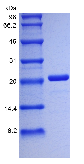 Recombinant Human Interleukin-6(rHu IL-6)