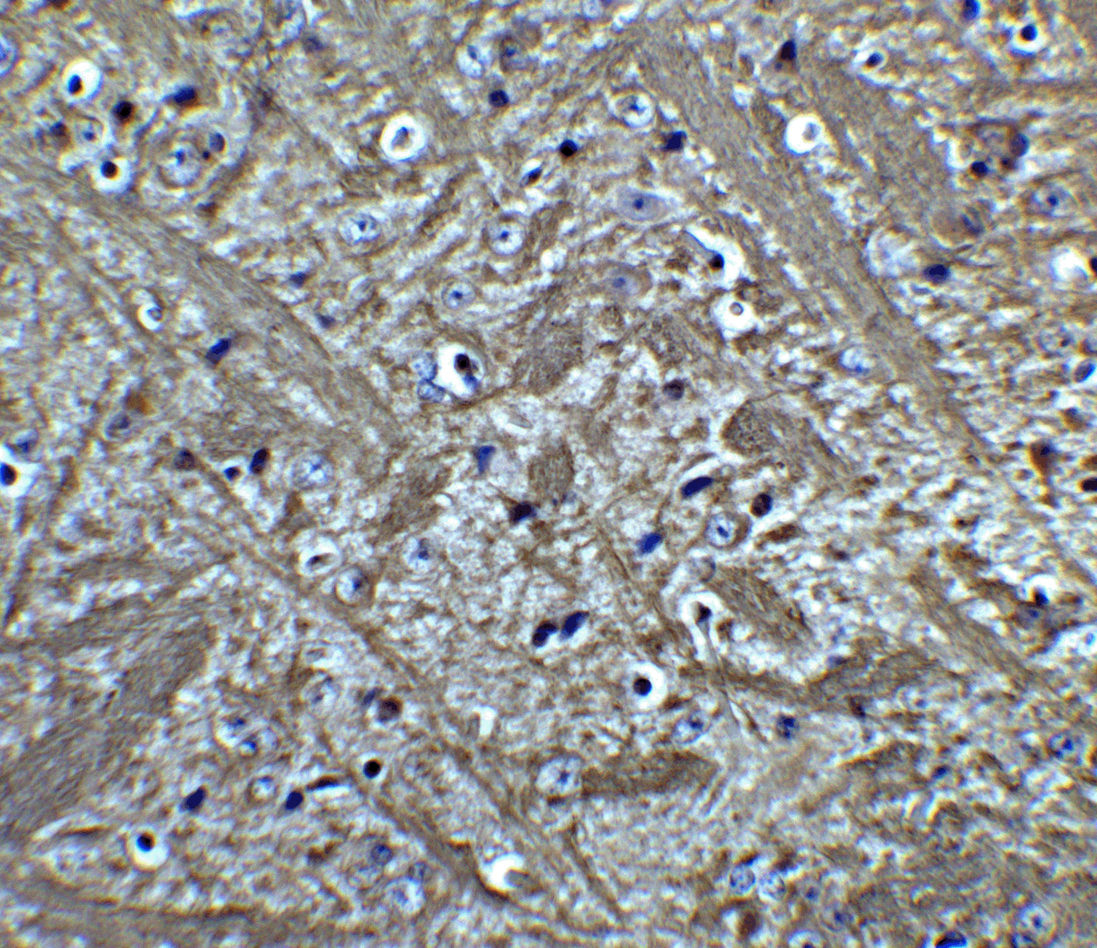 Bcl-2 Antibody