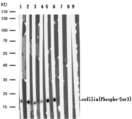 cofilin(Phospho-Ser3) Antibody