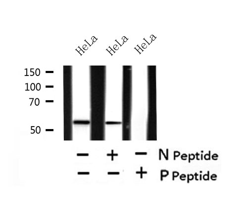 MLKL  (Phospho-Ser125) Antibody
