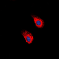 EPHA2 (phospho-Tyr588/596) Antibody