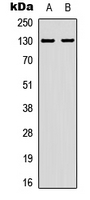 EPHA2 (phospho-Tyr588/596) Antibody