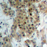 NEK9 (phospho-Thr210) Antibody