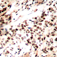 RAD51A (phospho-Tyr315) Antibody